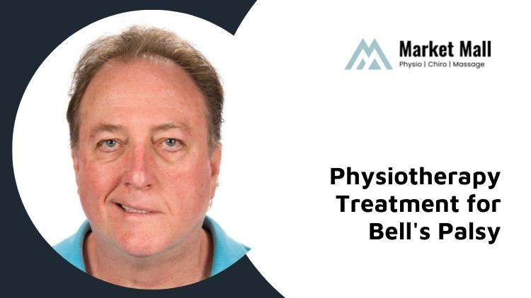 https://marketmallphysio.ca/wp-content/uploads/physiotherapy-for-bells-palsy-calgary-nw.jpg